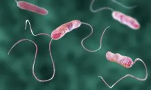 Công nhân Bắc Giang nhập viện do vi khuẩn E.coli và tụ cầu vàng